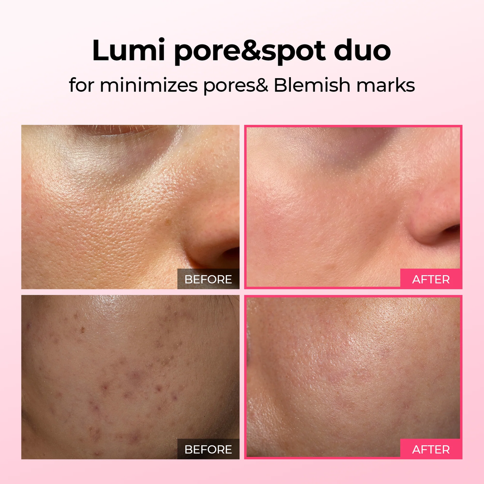 Pore & Blemish Corrector Duo