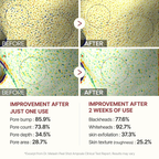 Rice Peeling Radiance Serum