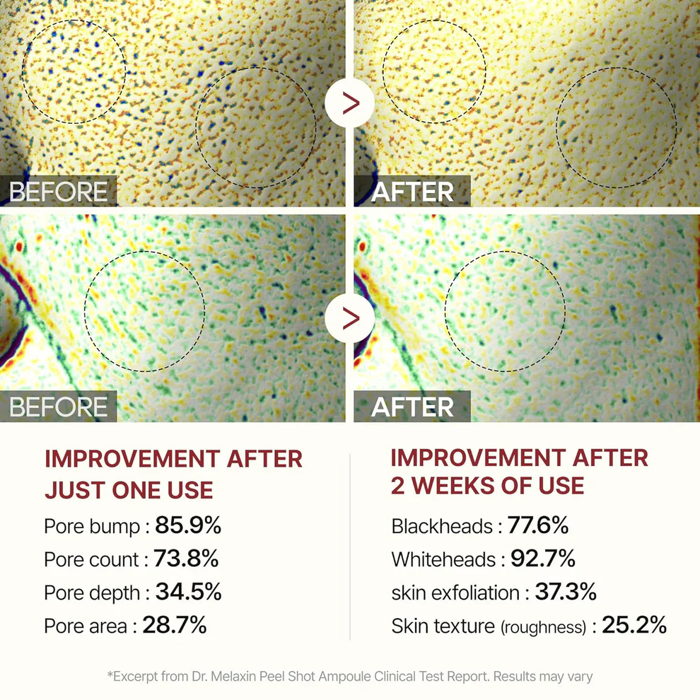 Rice Peeling Radiance Serum